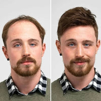 Full Lace Toupee For Men Human Hair Systems Unit Men's Lace Base Wig Breathable Male Capillary Prothesis Man Wigs